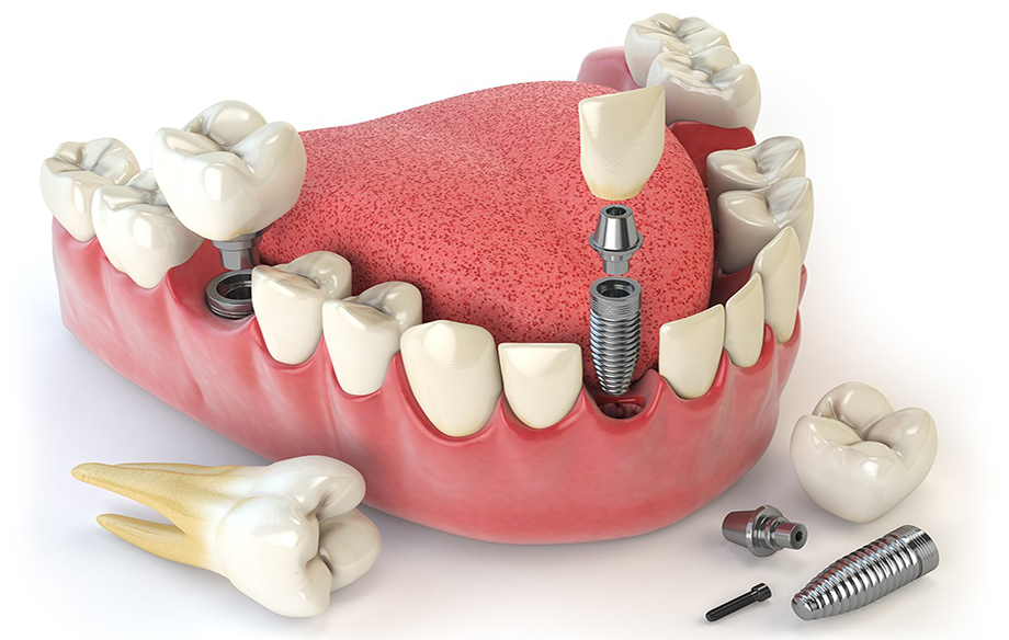 Prosthodontics